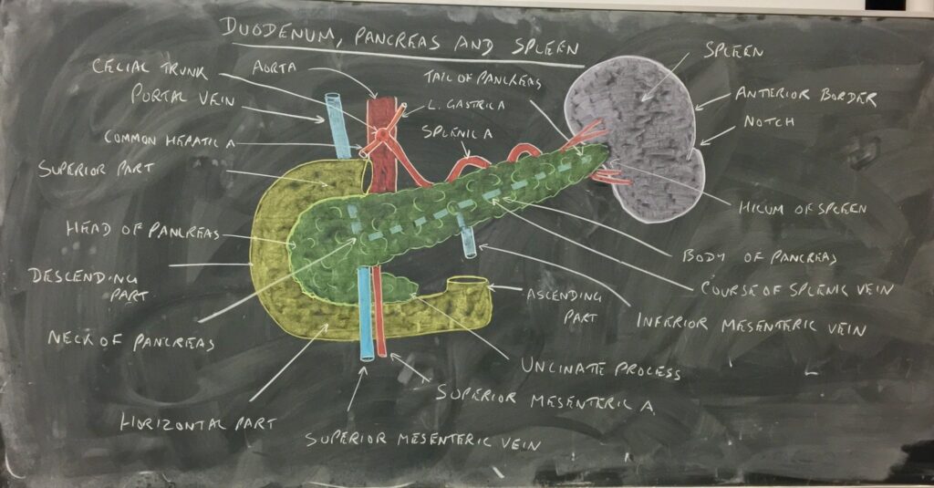 PBLの授業で先生が描いた膵臓とその周辺の臓器